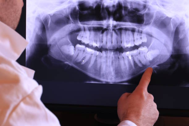 Best Emergency Dentist for Knocked-Out Tooth in Holladay, UT